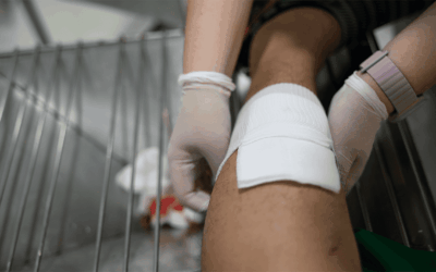 Lesión por fricción: Abrasiones (raspón)